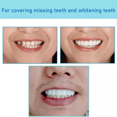 Instant Tandfacette – Perfekt Smil på Sekunder med Komfortabel Silikone Bonusvis