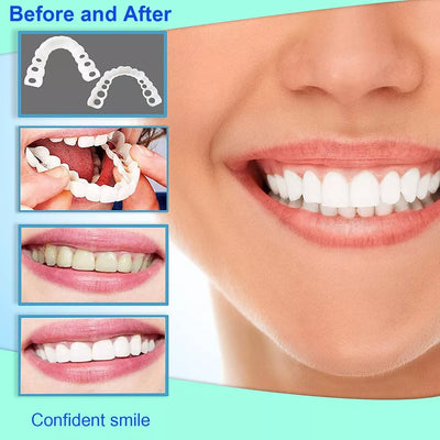 Instant Tandfacette – Perfekt Smil på Sekunder med Komfortabel Silikone Bonusvis