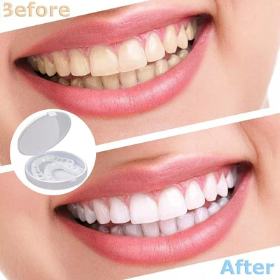 Instant Tandfacette – Perfekt Smil på Sekunder med Komfortabel Silikone Bonusvis