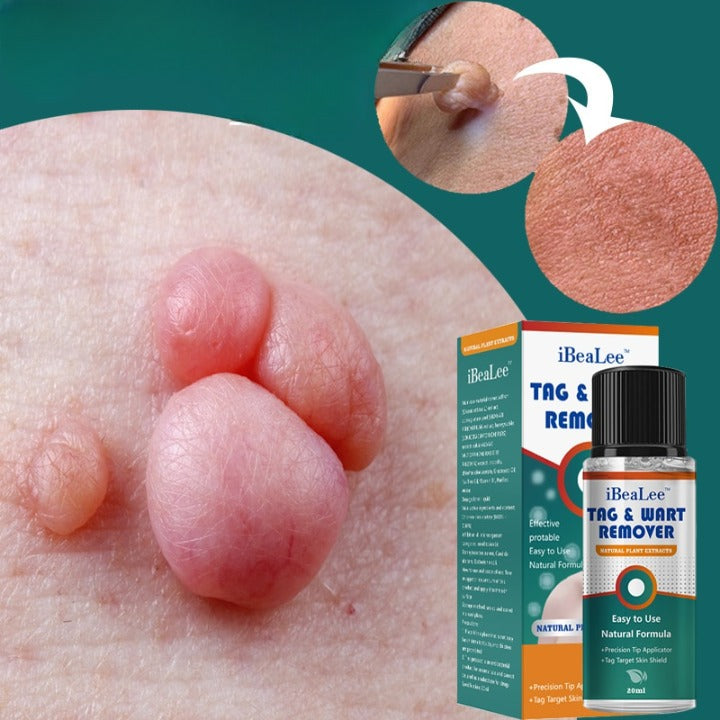 ClearSkinPro – Naturlig og Smertefri Løsning mod Hudmærker Bonusvis