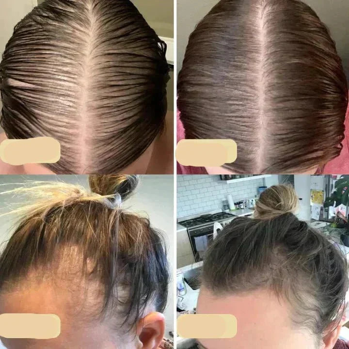Naturlig Hårvækstolie – Styrk og Forny Dit Hår Bonusvis