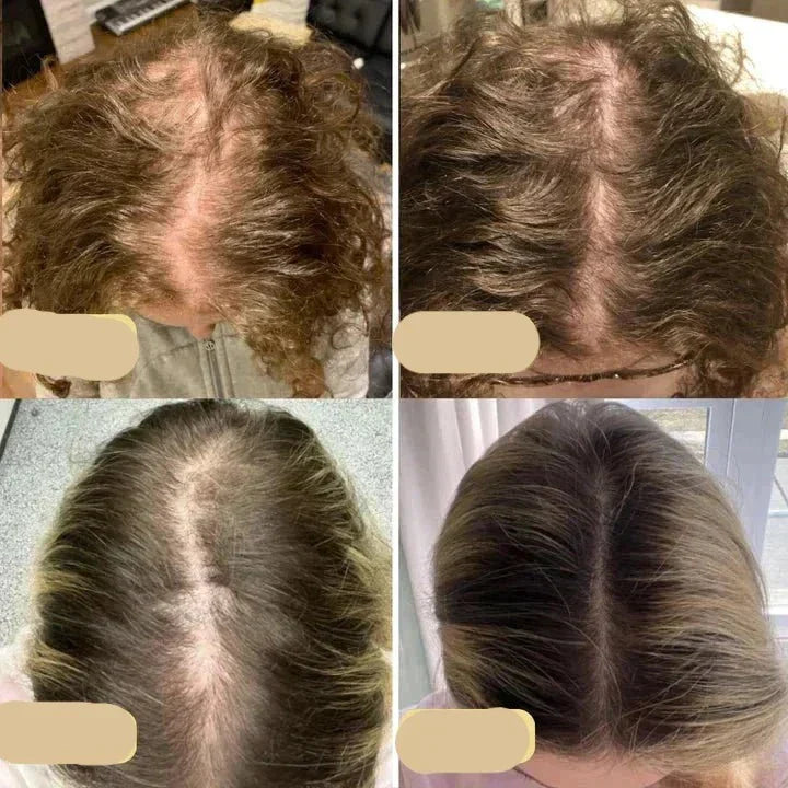 Naturlig Hårvækstolie – Styrk og Forny Dit Hår Bonusvis